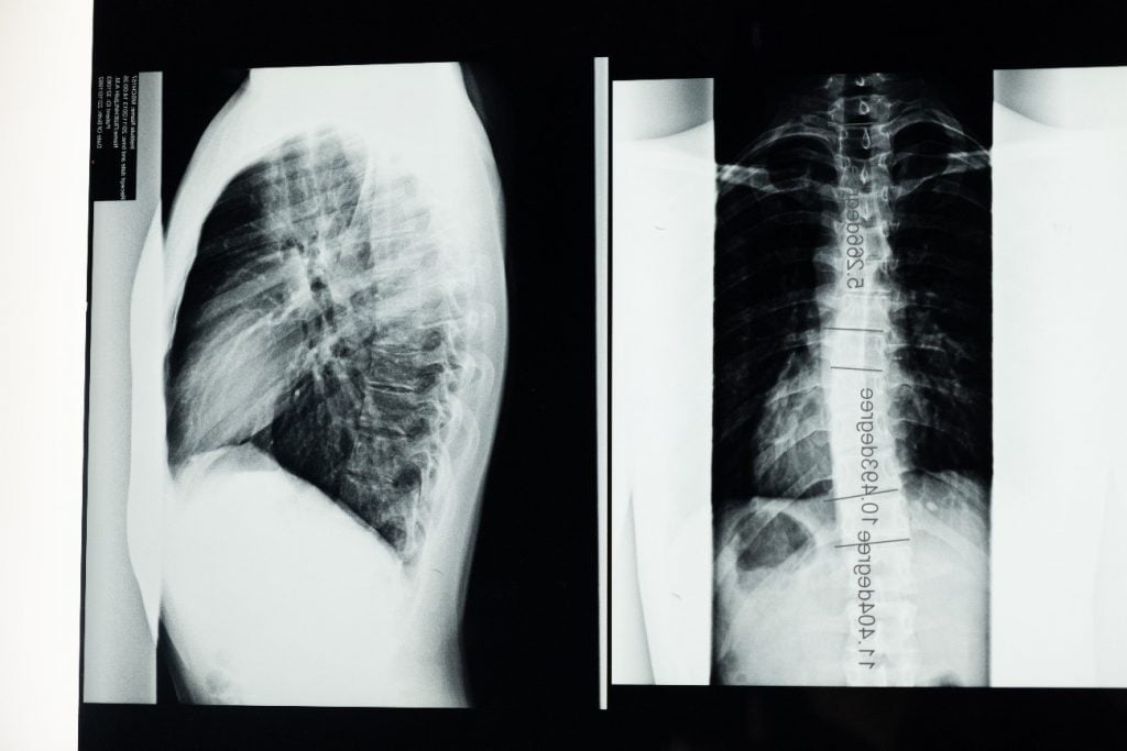 Imagem De Radiologia