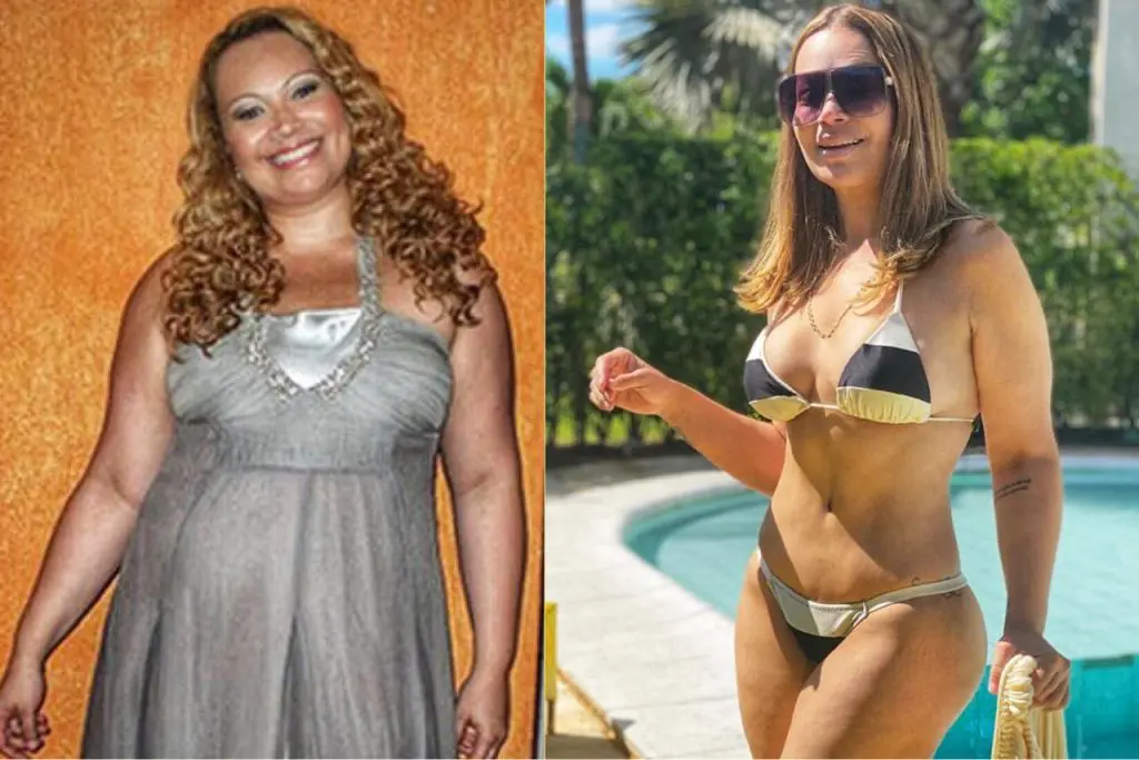 chip da beleza,famosas solange almeida após implante de hormonios