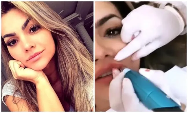 Kelly Key fazendo micropigmentação labial
